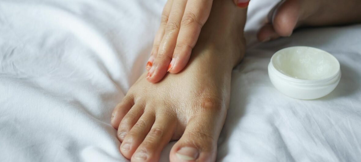 Best Hand and Foot Lotion for Dancers and Callus Care Cream: Top 7 Picks for 2026